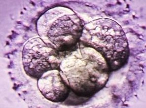 试管促排卵方案都有哪些？试管促排方案大全